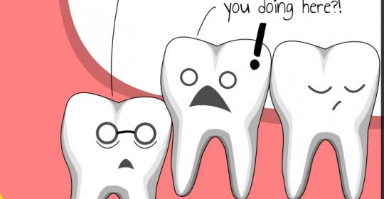 دندان های نهفته ، علائم و درمان
