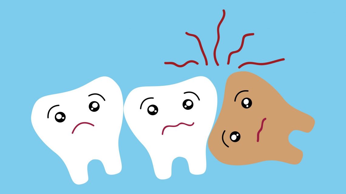 دندان های نهفته ، علائم و درمان