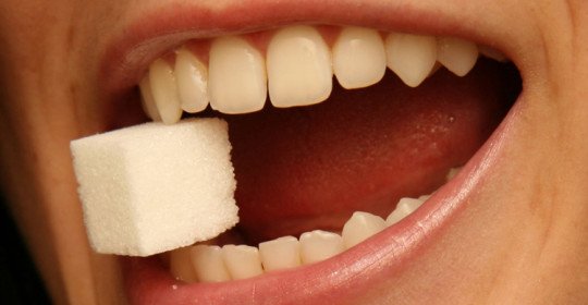 پوسیدگی دندان و قند و شکر