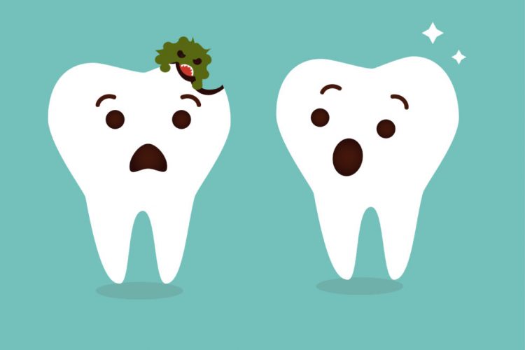 پیشگیری از پوسیدگی دندان